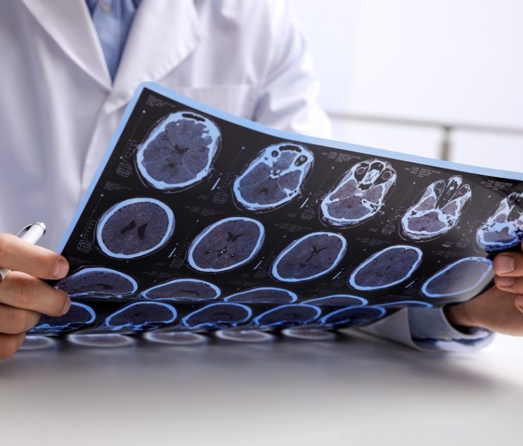 Brain MRI Imaging Near Cumberland, Maryland: What Patients Should Know