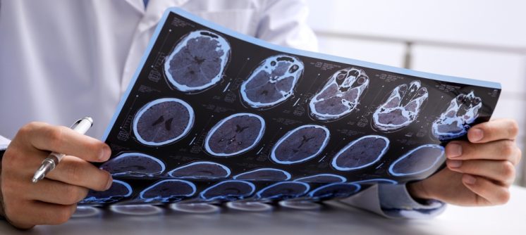 Brain MRI Imaging Near Cumberland, Maryland: What Patients Should Know