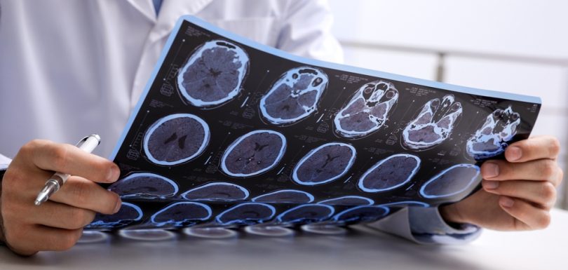 Brain MRI Imaging Near Cumberland, Maryland: What Patients Should Know