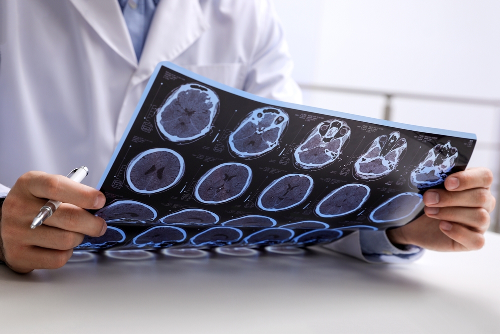 Brain MRI Imaging Near Cumberland, Maryland: What Patients Should Know