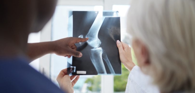 X-Ray Appointment Near Cumberland, Maryland: Walk-In Imaging Questions and Results Timeline