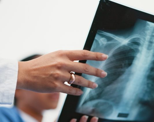 Walk In X Ray Near Martinsburg, West Virginia