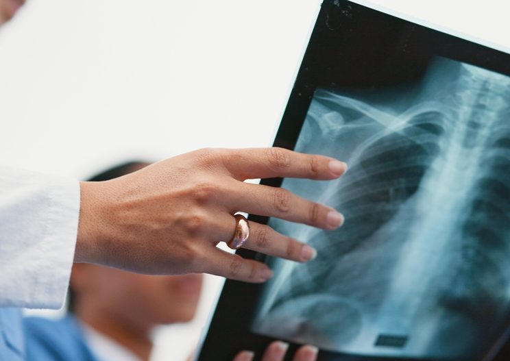 Walk In X Ray Near Martinsburg, West Virginia