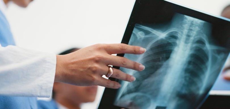 Walk In X Ray Near Martinsburg, West Virginia