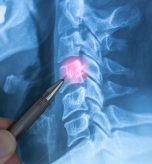 Diagnostic X-Ray Appointments in Martinsburg, WV for Fractures, Arthritis, and Joint Pain