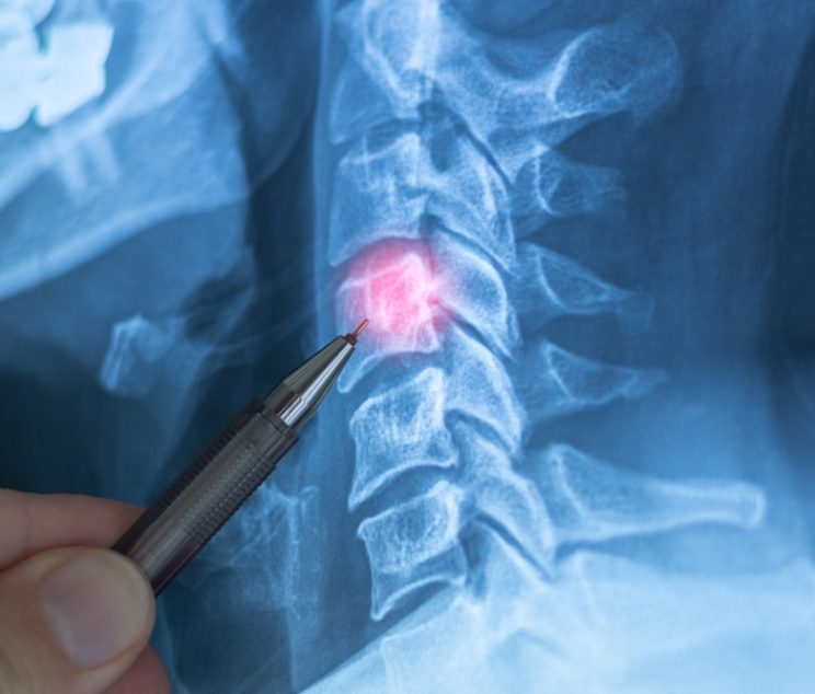 Diagnostic X-Ray Appointments in Martinsburg, WV for Fractures, Arthritis, and Joint Pain