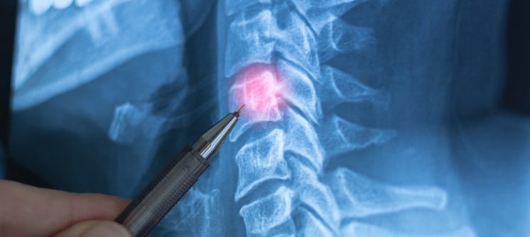 Diagnostic X-Ray Appointments in Martinsburg, WV for Fractures, Arthritis, and Joint Pain
