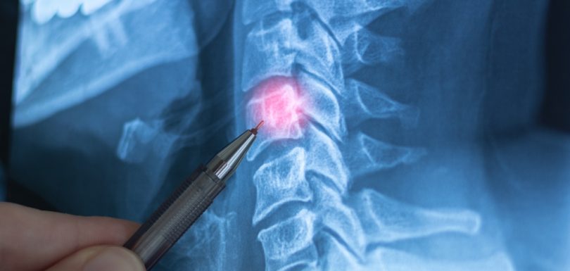 Diagnostic X-Ray Appointments in Martinsburg, WV for Fractures, Arthritis, and Joint Pain