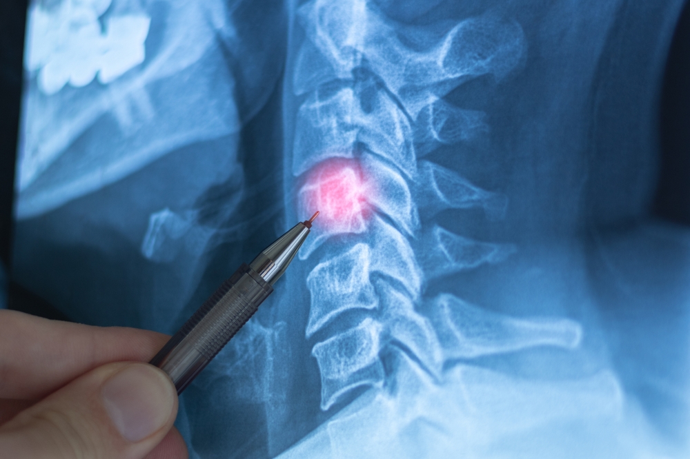 Diagnostic X-Ray Appointments in Martinsburg, WV for Fractures, Arthritis, and Joint Pain