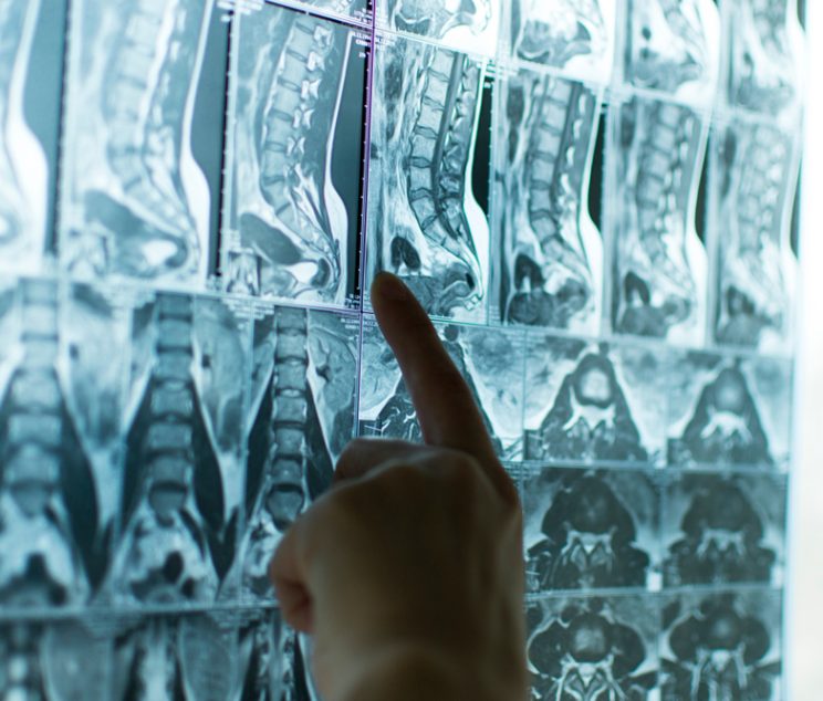 Same-Day MRI Appointments in Frederick MD for Spine and Joint Imaging