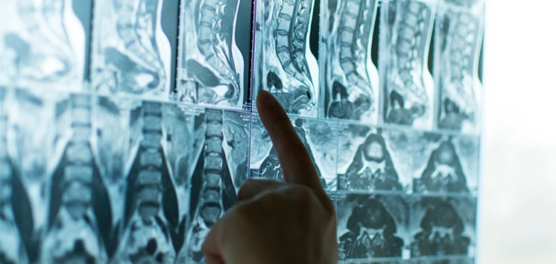 Same-Day MRI Appointments in Frederick MD for Spine and Joint Imaging