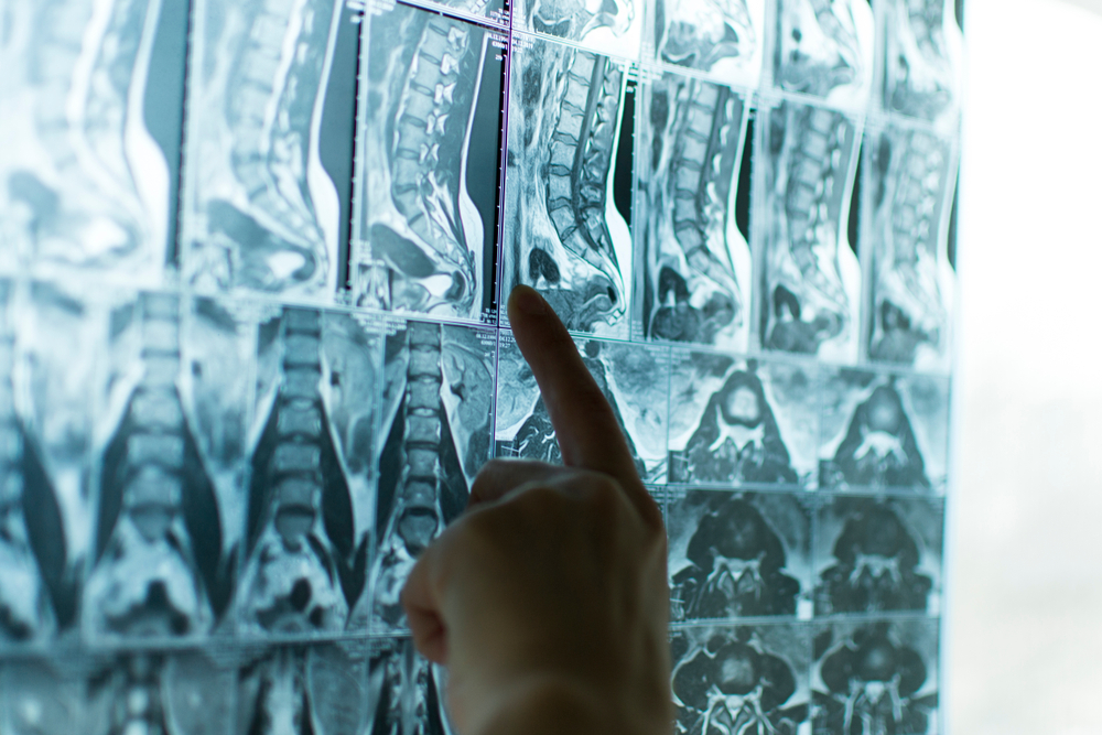 Same-Day MRI Appointments in Frederick MD for Spine and Joint Imaging