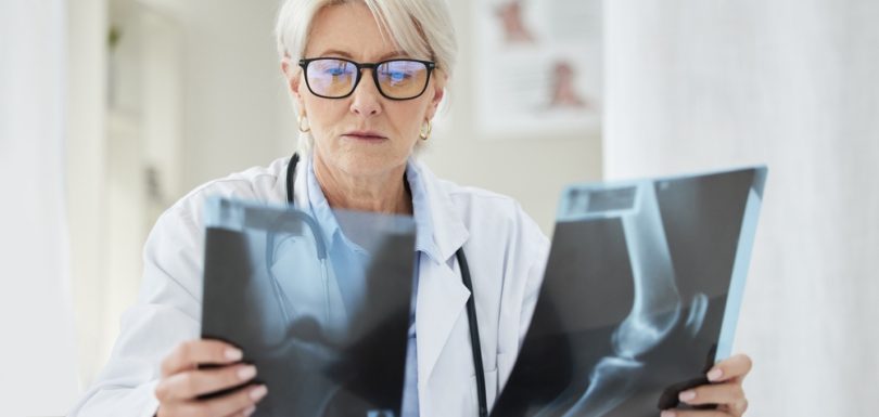 X-Ray Services Near Bedford, PA for Fractures, Chest Imaging, and More