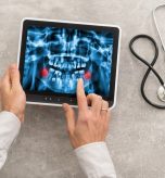 Walk-In Digital X-Ray Services in Cumberland MD for Sports Injuries