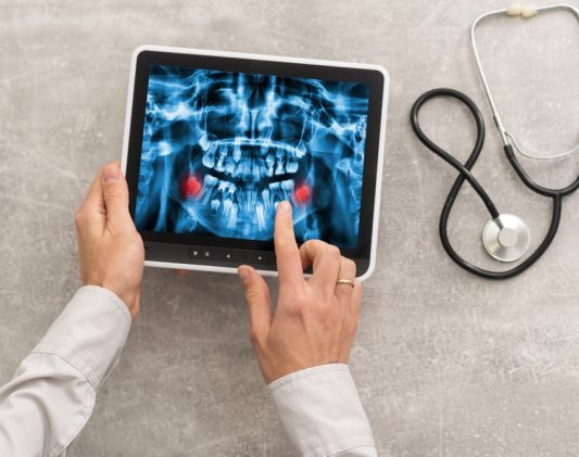 Walk-In Digital X-Ray Services in Cumberland MD for Sports Injuries