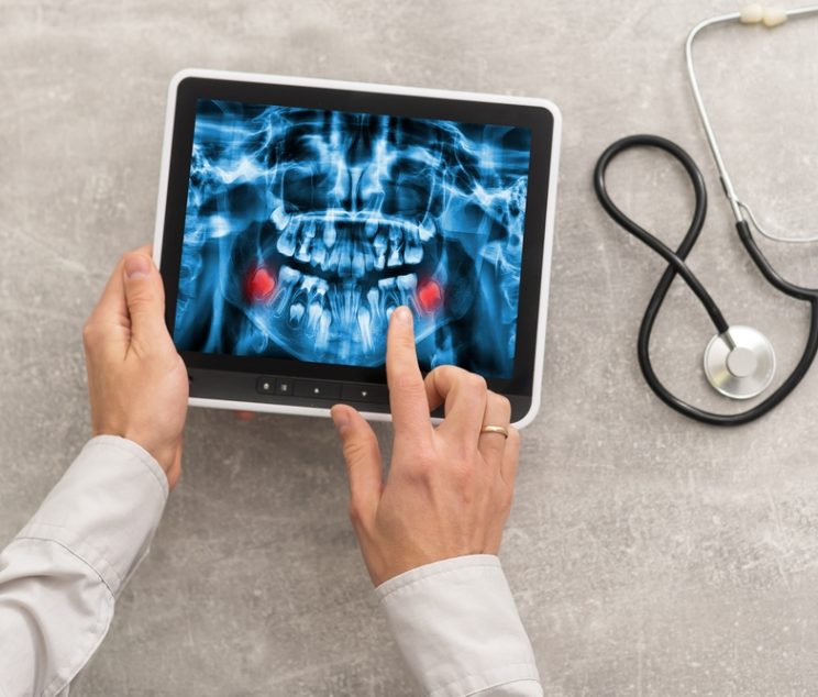 Walk-In Digital X-Ray Services in Cumberland MD for Sports Injuries