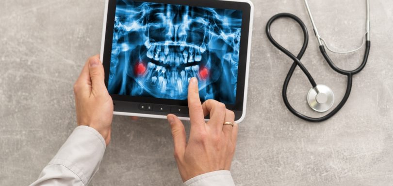 Walk-In Digital X-Ray Services in Cumberland MD for Sports Injuries