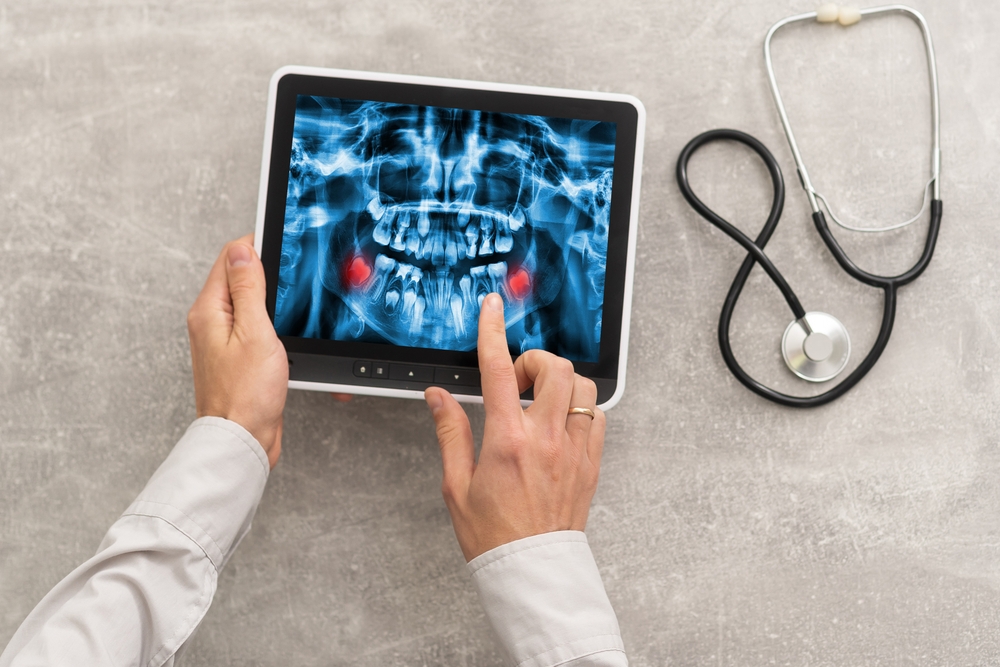 Walk-In Digital X-Ray Services in Cumberland MD for Sports Injuries