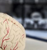 Brain Scans for Parkinsons Disease Near Cumberland and Hagerstown, MD