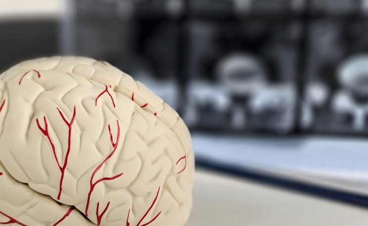 Brain Scans for Parkinsons Disease Near Cumberland and Hagerstown, MD