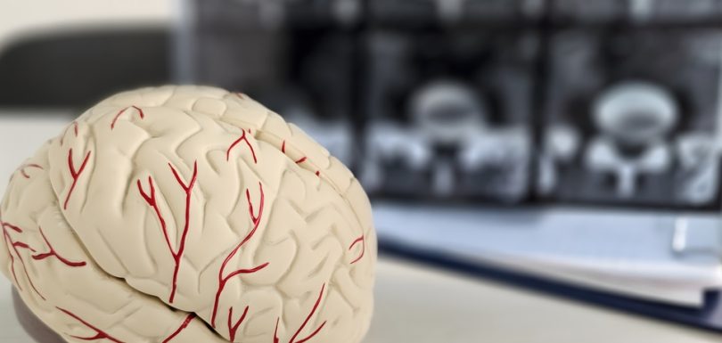 Brain Scans for Parkinsons Disease Near Cumberland and Hagerstown, MD