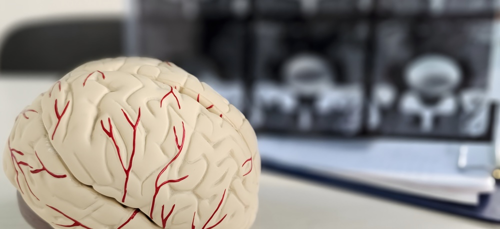 Brain Scans for Parkinsons Disease Near Cumberland and Hagerstown, MD